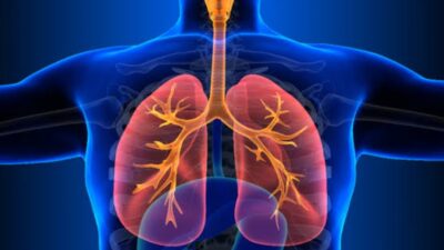 Kenali Kelompok yang Berisiko Tinggi Tertular TBC